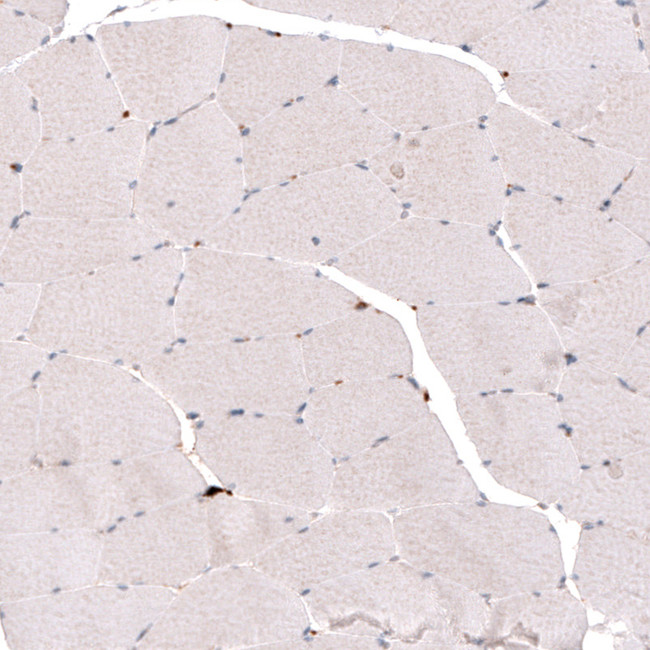 SLC16A2 Antibody in Immunohistochemistry (IHC)