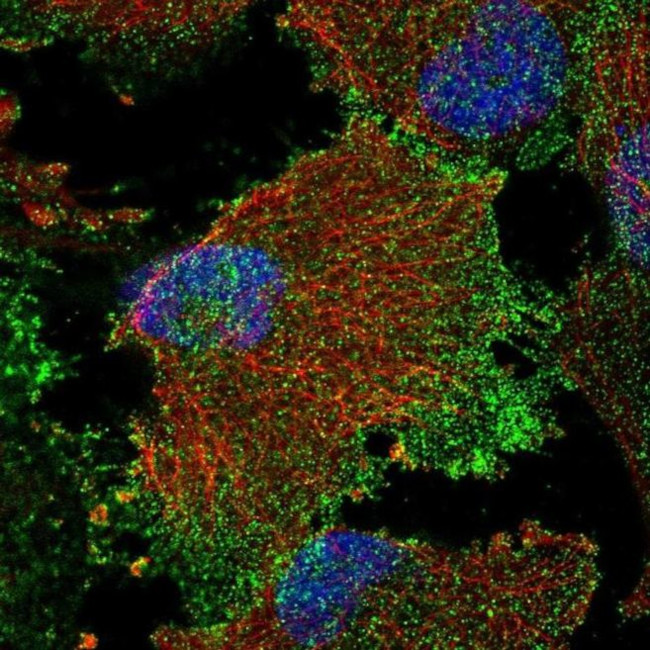 SLC16A2 Antibody in Immunocytochemistry (ICC/IF)