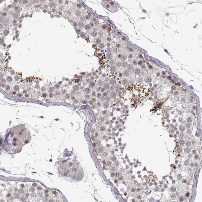 C10orf62 Antibody in Immunohistochemistry (IHC)