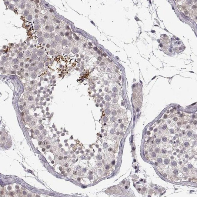 C10orf62 Antibody in Immunohistochemistry (IHC)