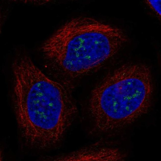 UBE2W Antibody in Immunocytochemistry (ICC/IF)