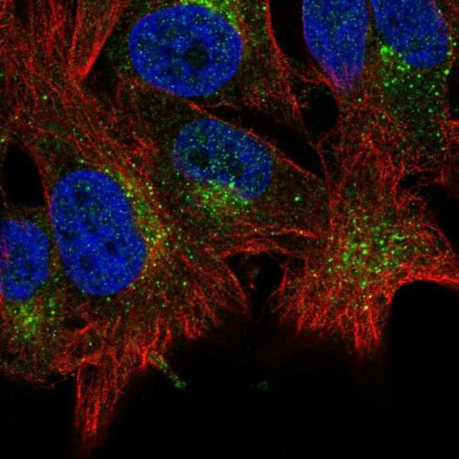 ABHD6 Antibody in Immunocytochemistry (ICC/IF)