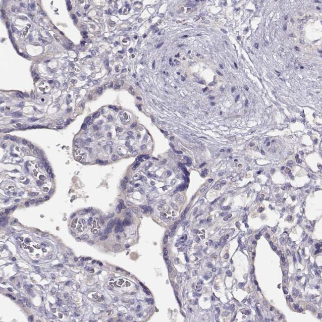 KIF19 Antibody in Immunohistochemistry (IHC)