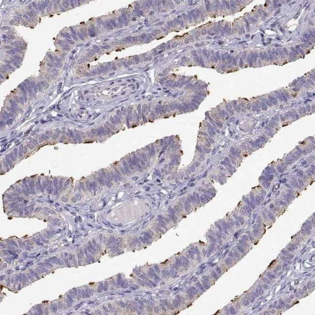 KIF19 Antibody in Immunohistochemistry (IHC)