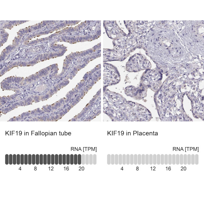 KIF19 Antibody