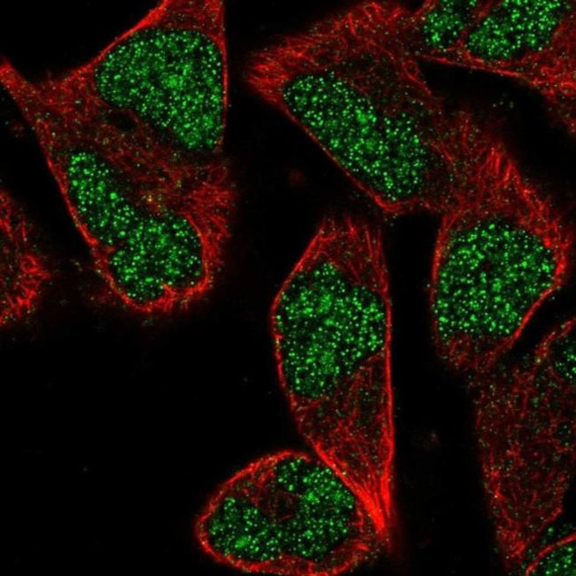 ZNF627 Antibody in Immunocytochemistry (ICC/IF)