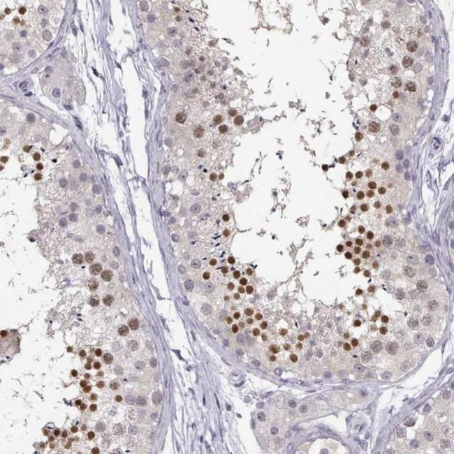 C16orf86 Antibody in Immunohistochemistry (IHC)