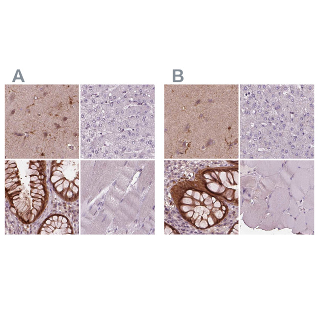 Sorcin Antibody in Immunohistochemistry (IHC)