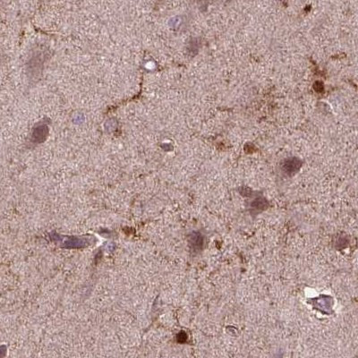 Sorcin Antibody in Immunohistochemistry (IHC)