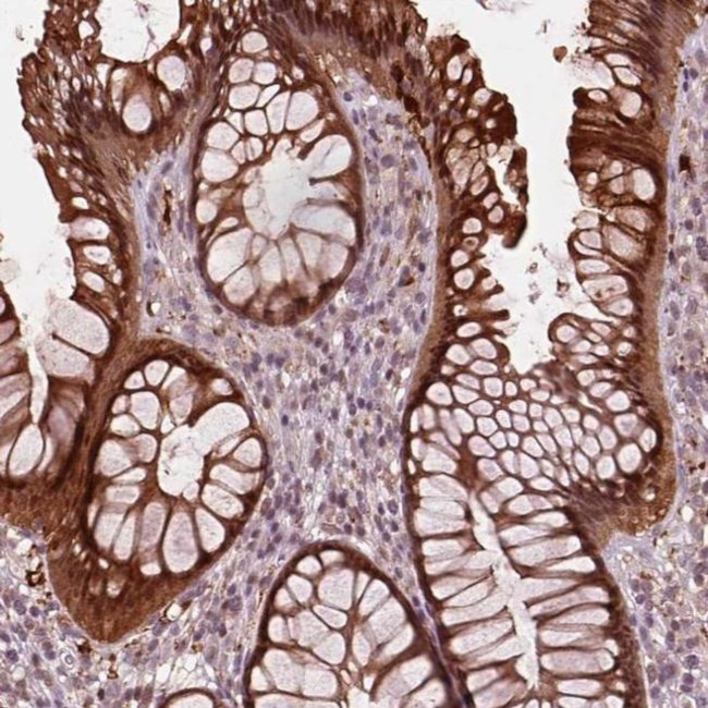 Sorcin Antibody in Immunohistochemistry (IHC)