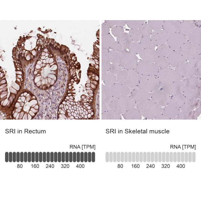 Sorcin Antibody