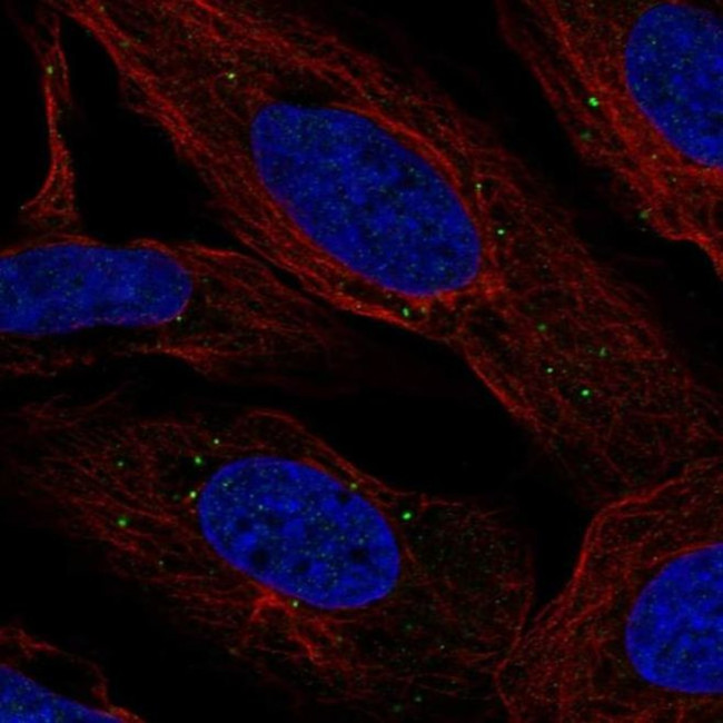 LMNTD2 Antibody in Immunocytochemistry (ICC/IF)