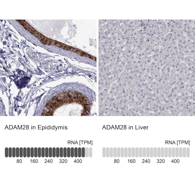 ADAM28 Antibody in Immunohistochemistry (IHC)