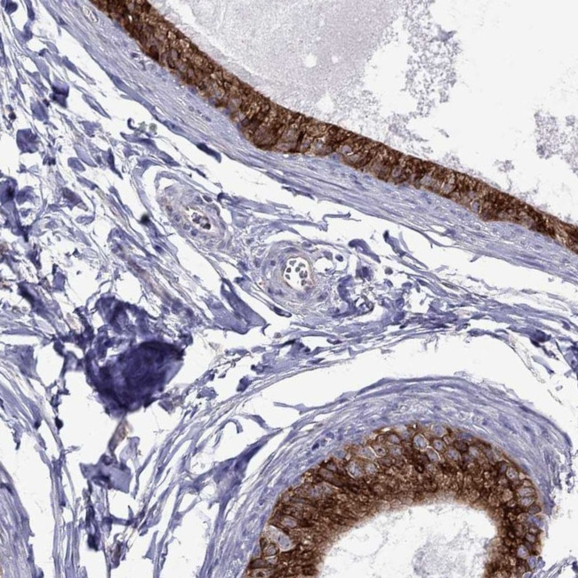 ADAM28 Antibody in Immunohistochemistry (IHC)