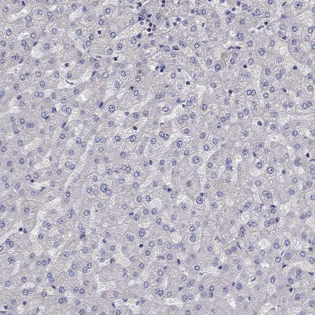 ADAM28 Antibody in Immunohistochemistry (IHC)