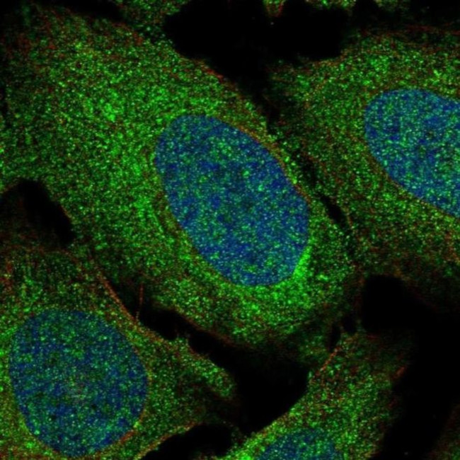 ADAM28 Antibody in Immunocytochemistry (ICC/IF)