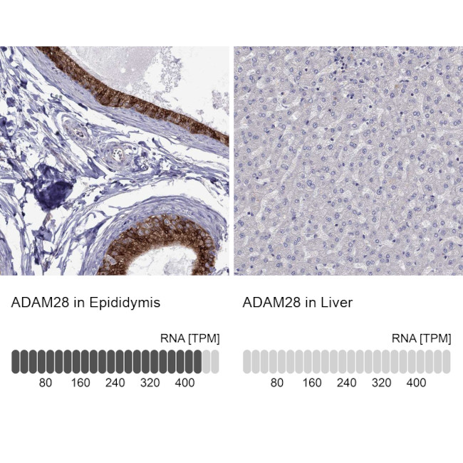 ADAM28 Antibody