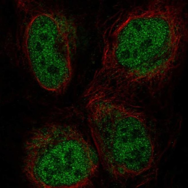 ZBTB47 Antibody in Immunocytochemistry (ICC/IF)