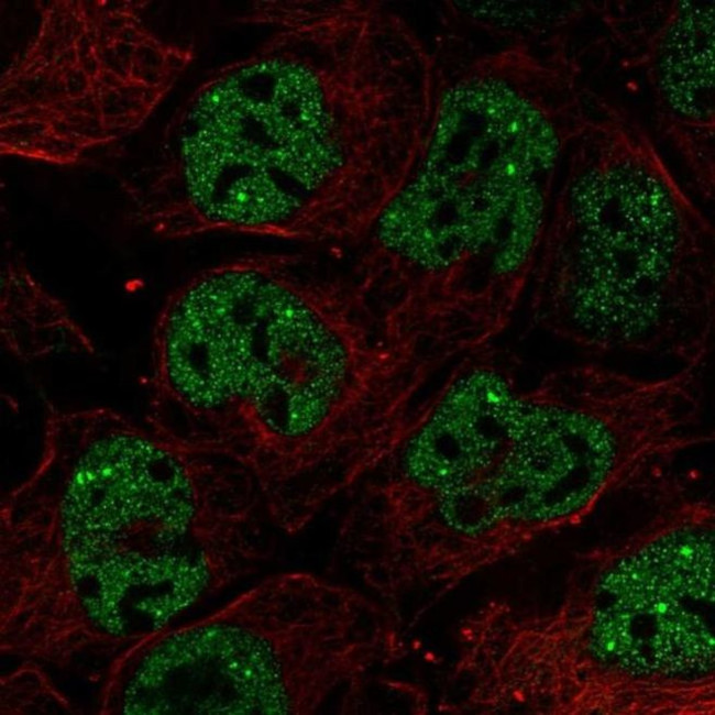 RNF34 Antibody in Immunocytochemistry (ICC/IF)