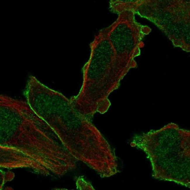 PALM2 Antibody in Immunocytochemistry (ICC/IF)