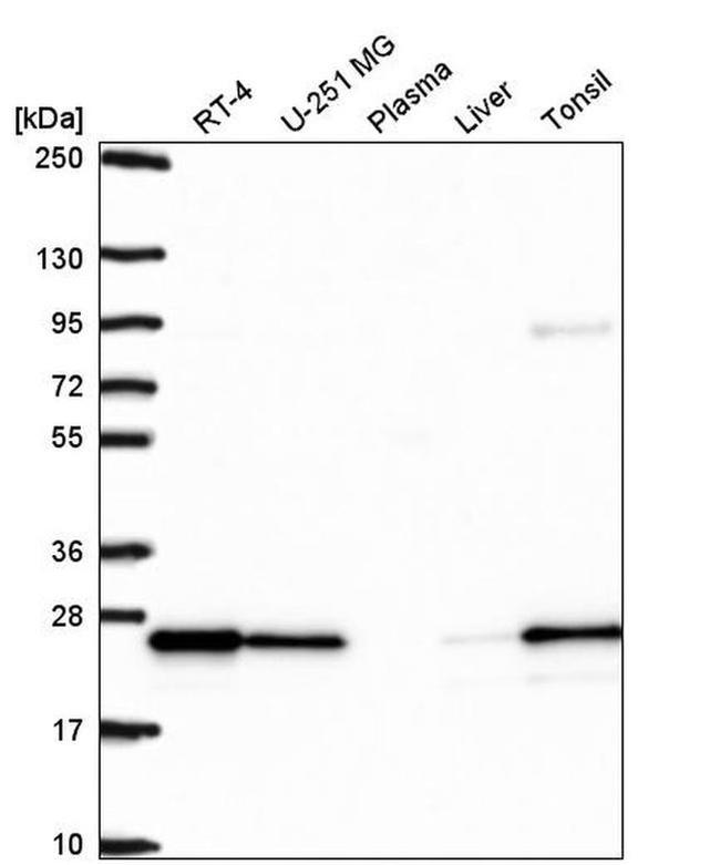 RAB8B Antibody in Western Blot (WB)