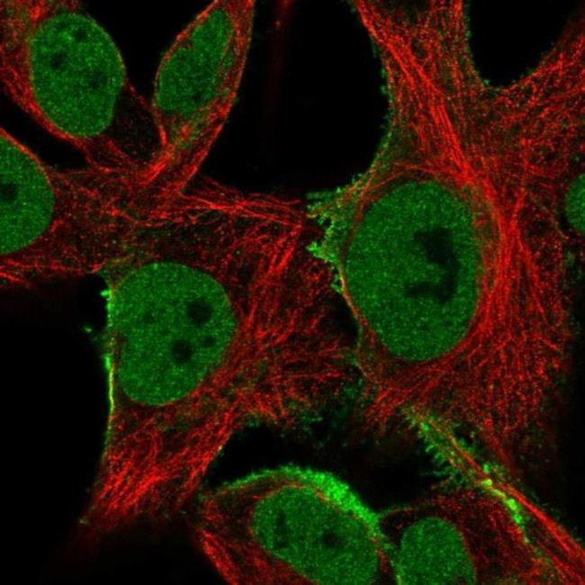 SGCE Antibody in Immunocytochemistry (ICC/IF)