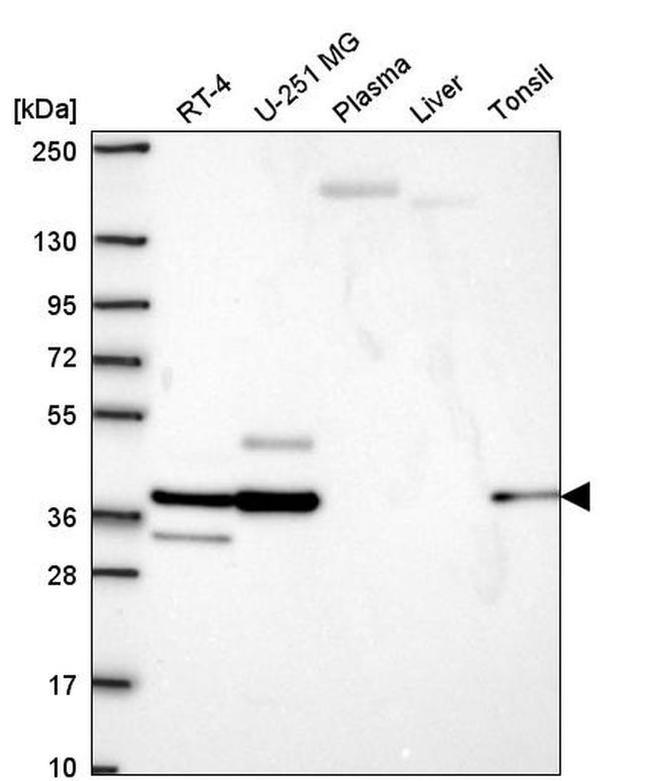 SGCE Antibody in Western Blot (WB)