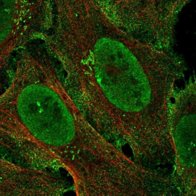 ZCCHC5 Antibody in Immunocytochemistry (ICC/IF)