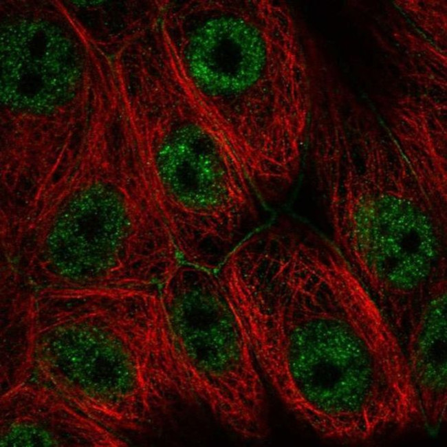 PI4KA Antibody in Immunocytochemistry (ICC/IF)