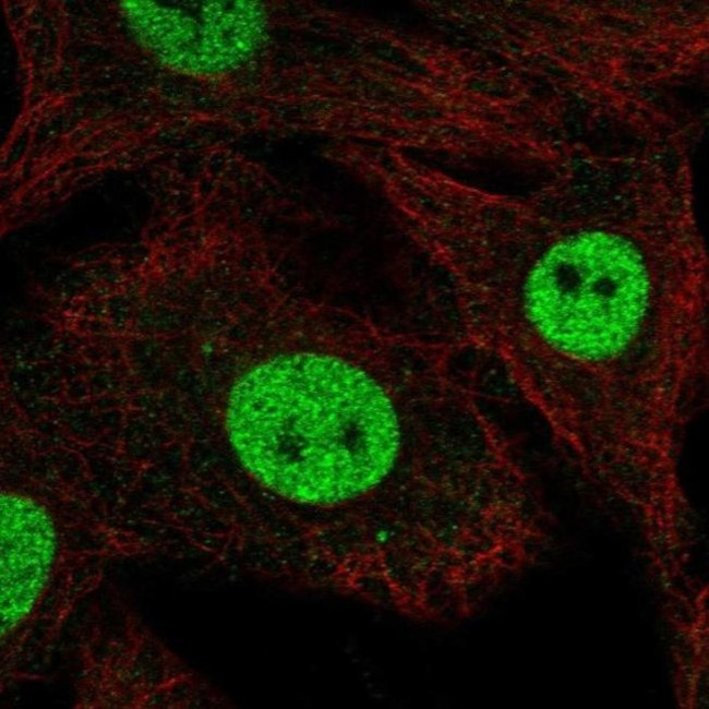 RFWD3 Antibody in Immunocytochemistry (ICC/IF)