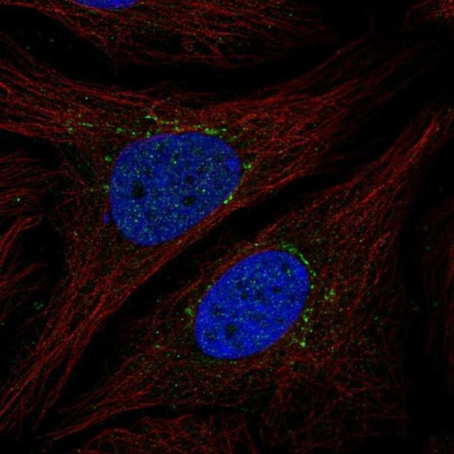 STEAP4 Antibody in Immunocytochemistry (ICC/IF)