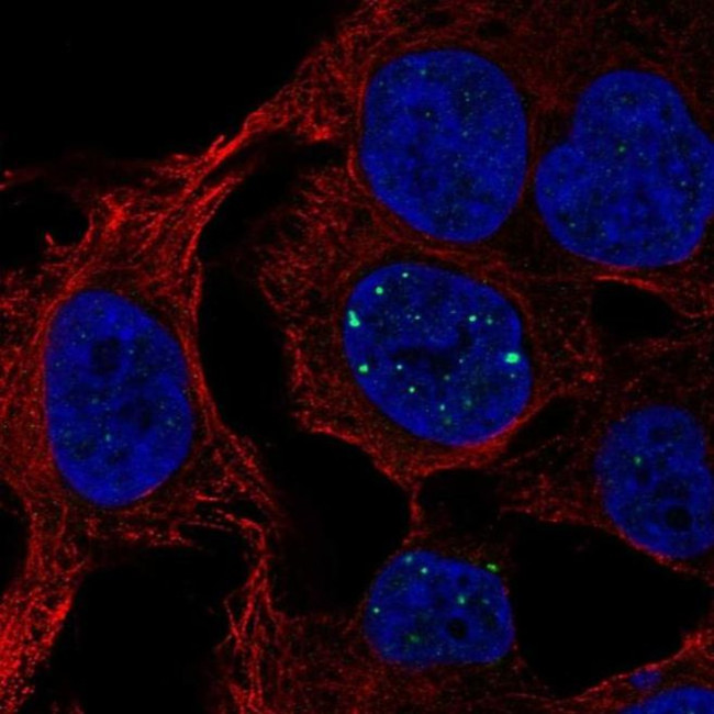 SH3BGRL3 Antibody in Immunocytochemistry (ICC/IF)