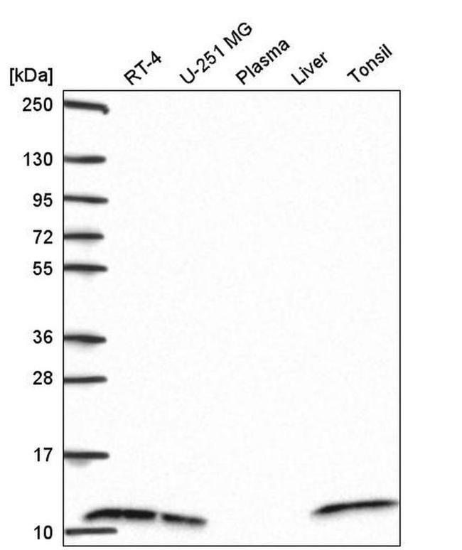 SH3BGRL3 Antibody in Western Blot (WB)