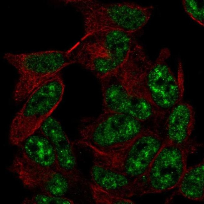 TADA2L Antibody in Immunocytochemistry (ICC/IF)