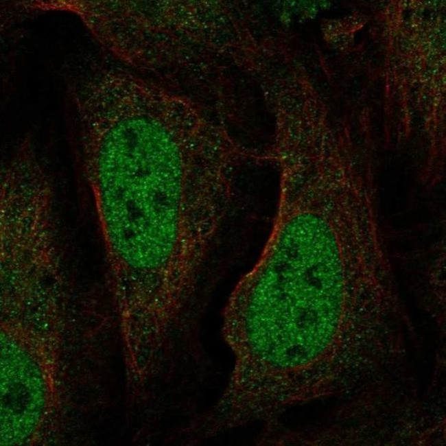 BAAT1 Antibody in Immunocytochemistry (ICC/IF)