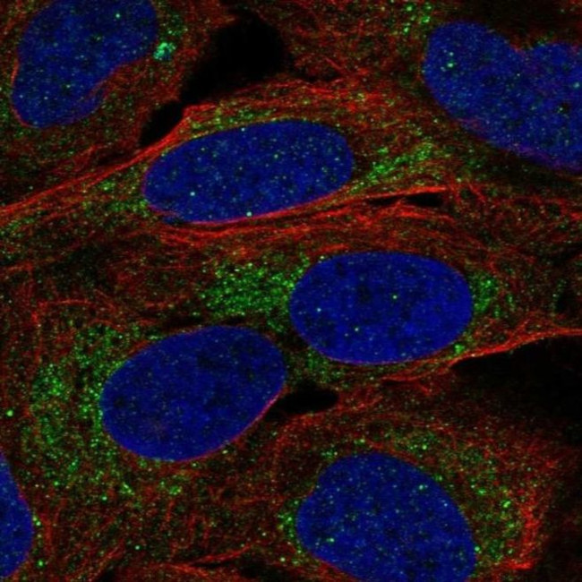 A4GALT Antibody in Immunocytochemistry (ICC/IF)