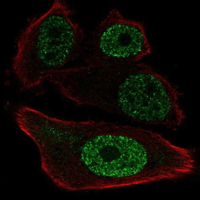 ETV1 Antibody in Immunocytochemistry (ICC/IF)