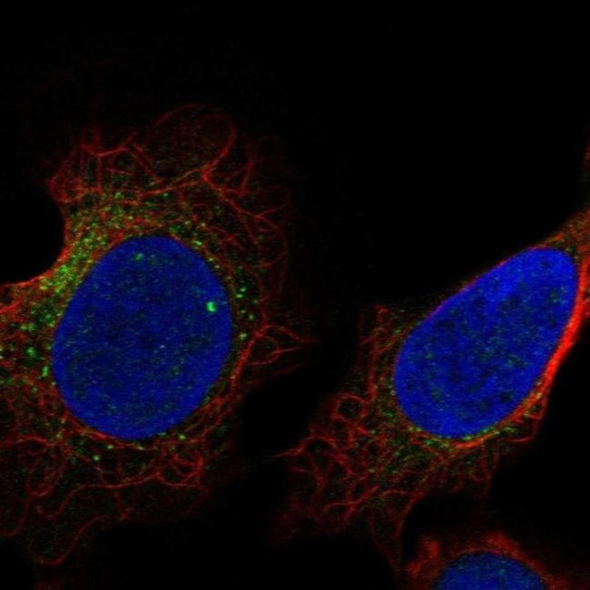 USP27X Antibody in Immunocytochemistry (ICC/IF)