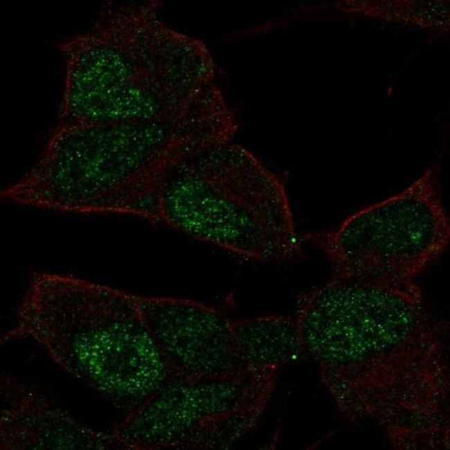 TCF9 Antibody in Immunocytochemistry (ICC/IF)