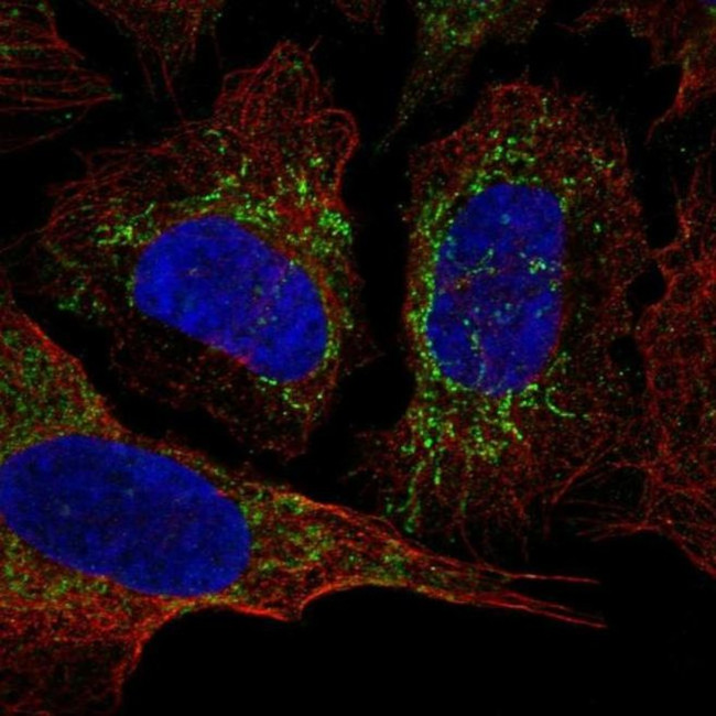 KCNAB3 Antibody in Immunocytochemistry (ICC/IF)