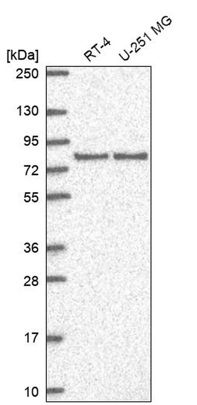 SAP102 Antibody in Western Blot (WB)