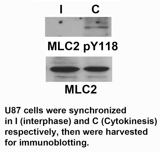 Phospho-MYL2 (Tyr118) Antibody in Western Blot (WB)