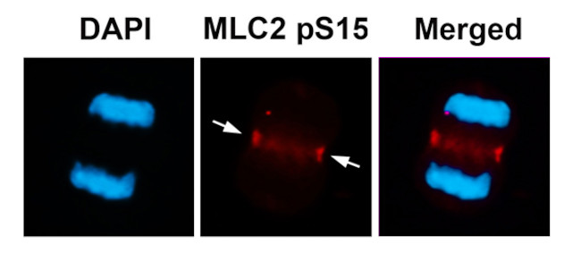 Phospho-MYL2 (Ser15) Antibody in Immunocytochemistry (ICC/IF)