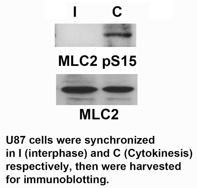 Phospho-MYL2 (Ser15) Antibody in Western Blot (WB)