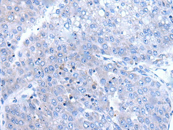 BTG4 Antibody in Immunohistochemistry (Paraffin) (IHC (P))