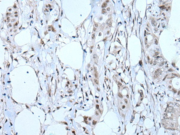 TBX6 Antibody in Immunohistochemistry (Paraffin) (IHC (P))