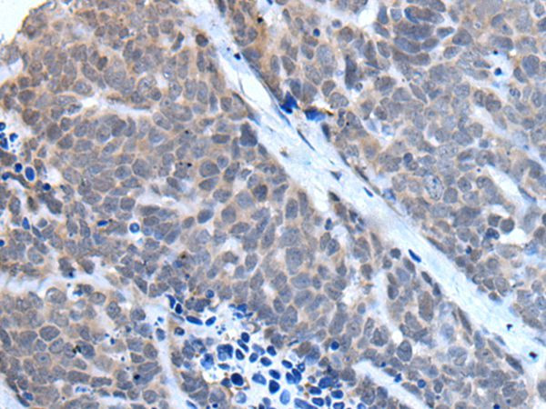 TBX6 Antibody in Immunohistochemistry (Paraffin) (IHC (P))