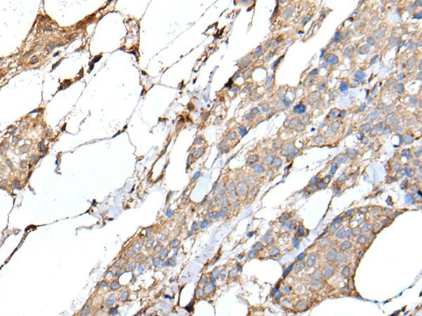 IL-20 Antibody in Immunohistochemistry (Paraffin) (IHC (P))