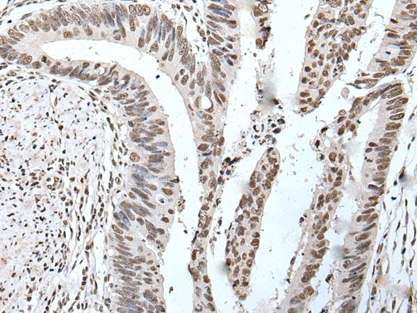 POT1 Antibody in Immunohistochemistry (Paraffin) (IHC (P))