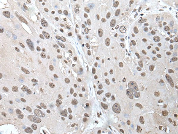 POT1 Antibody in Immunohistochemistry (Paraffin) (IHC (P))